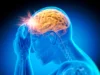 Para ilmuwan memperingatkan bahwa pedoman vitamin B12 saat ini dapat membahayakan otak Anda