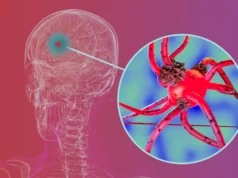 Para peneliti memblokir protein kunci yang membantu penyakit Parkinson menyebar di otak