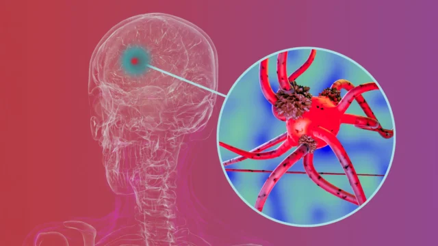 Para peneliti memblokir protein kunci yang membantu penyakit Parkinson menyebar