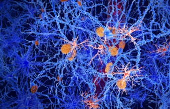 Para ilmuwan memprogram ulang sel-sel kekebalan otak untuk melawan penyakit Alzheimer