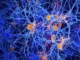 Para ilmuwan memprogram ulang sel-sel kekebalan otak untuk melawan penyakit Alzheimer