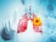 Studi besar menemukan vaping kemungkinan besar menyebabkan kanker paru-paru dan mulut