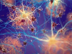 Tubulin mencegah gumpalan protein otak beracun yang terkait dengan penyakit Alzheimer dan Parkinson