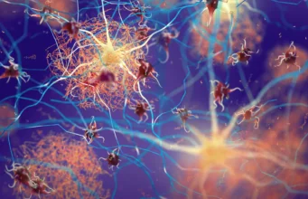 Tubulin mencegah gumpalan protein otak beracun yang terkait dengan penyakit Alzheimer dan Parkinson