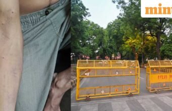 Demonstrasi CJP: demonstran lain mengaku terluka akibat peluru dan menyatakan “Saya pikir saya akan kehilangan lengan saya”
