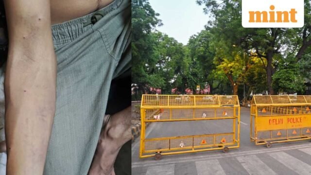 Demonstrasi CJP: demonstran lain mengaku terluka akibat peluru dan menyatakan