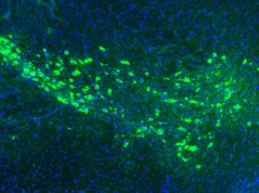Ilmuwan Yale mungkin telah menemukan bagaimana penyakit Parkinson menyebar di otak