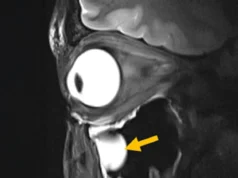 Kemajuan baru dalam MRI mengungkap otak dan mata dengan cara yang belum pernah ada sebelumnya