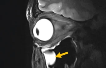 Kemajuan baru dalam MRI mengungkap otak dan mata dengan cara yang belum pernah ada sebelumnya