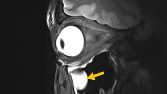 Kemajuan baru dalam MRI mengungkap otak dan mata dengan cara