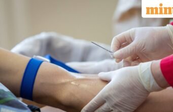 Kementerian Kesehatan merevisi standar diagnostik anemia untuk ibu hamil dan bayi, dan meluncurkan kerangka skrining baru