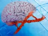 Obat Alzheimer baru memperbaiki kerusakan DNA, mengurangi peradangan otak