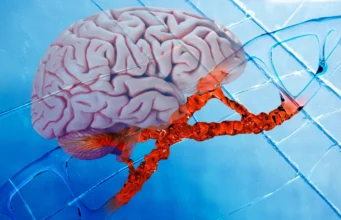 Obat Alzheimer baru memperbaiki kerusakan DNA, mengurangi peradangan otak