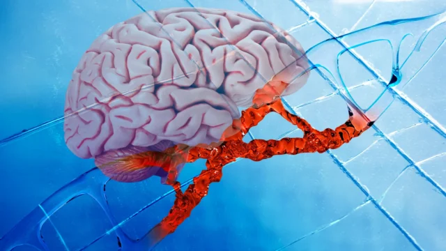 Obat Alzheimer baru memperbaiki kerusakan DNA, mengurangi peradangan otak