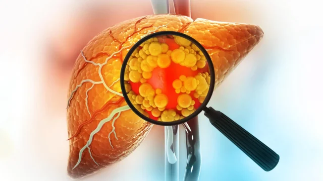 Obat eksperimental membalikkan penyakit hati berlemak yang parah dengan memperbaiki