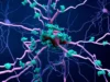 Para ilmuwan mungkin akhirnya menemukan bagaimana penyakit Alzheimer membunuh sel-sel otak