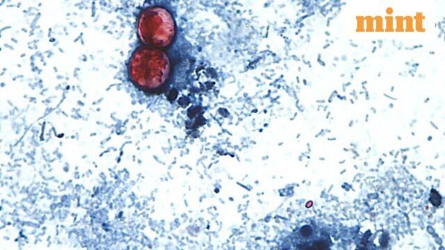 Parasit Cyclospora Menyebar di 34 Negara Bagian AS: Mengapa Kasus