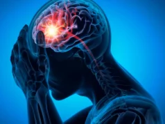 Penyebab sebenarnya dari stroke umum mungkin telah diabaikan selama beberapa dekade
