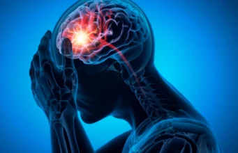 Penyebab sebenarnya dari stroke umum mungkin telah diabaikan selama beberapa dekade